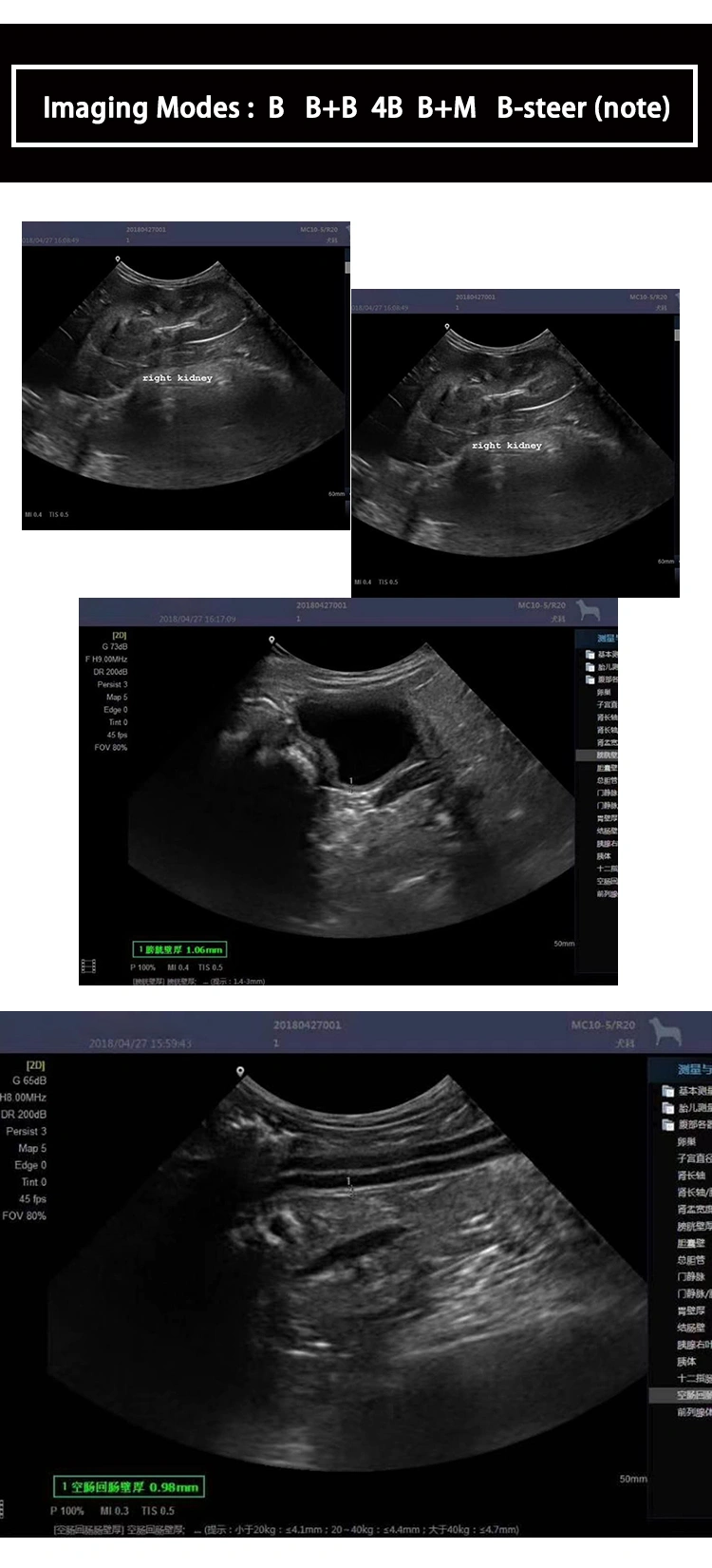 Ultrasound Scanner-4.jpg