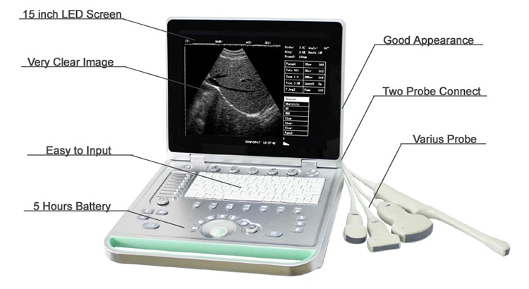 Ultrasound Scanner-1.jpg