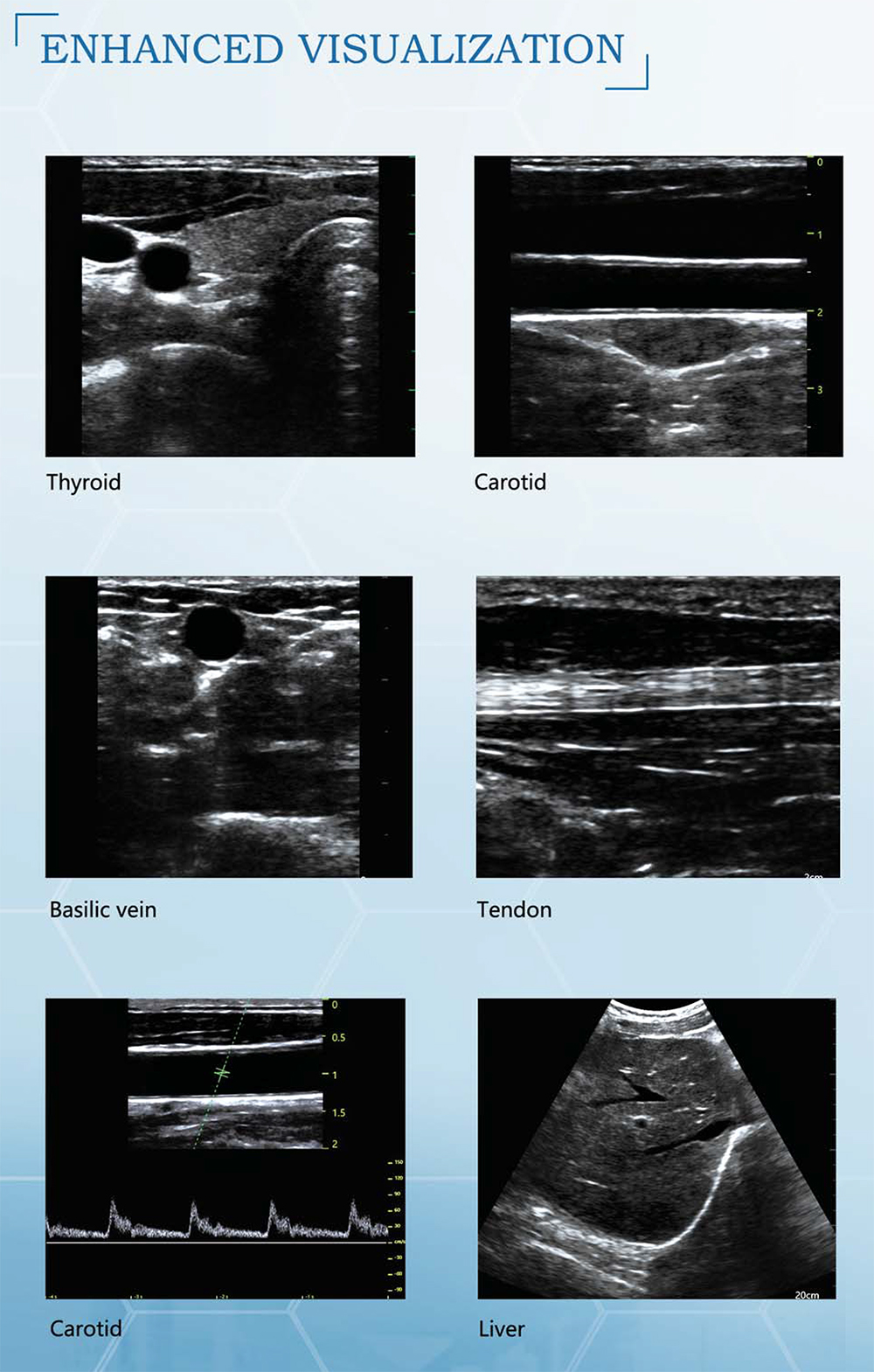 CATALOGUE-3.jpg