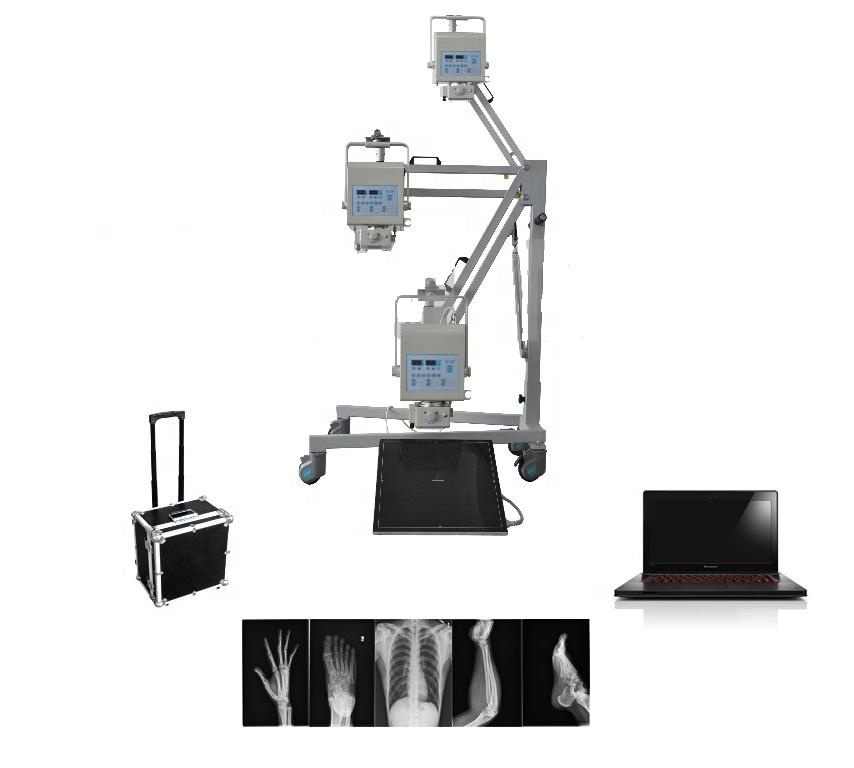 MY-D019A Digital Portable X-ray System.jpg