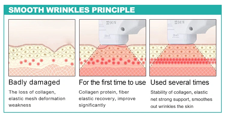 machine for home use/mini hifu for face lifting