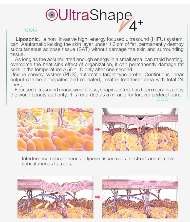 Portable Ultrasound Liposonic Machine Professional Body Slimming Lipo Ultrashape Machine