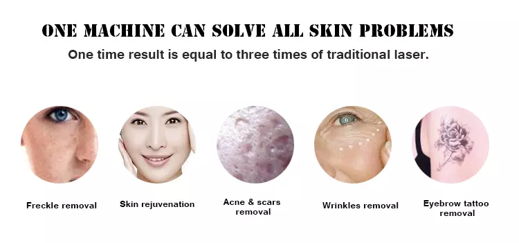 Portable picosecond 755nm/ 532nm/1064nm picosecond laser hair removal