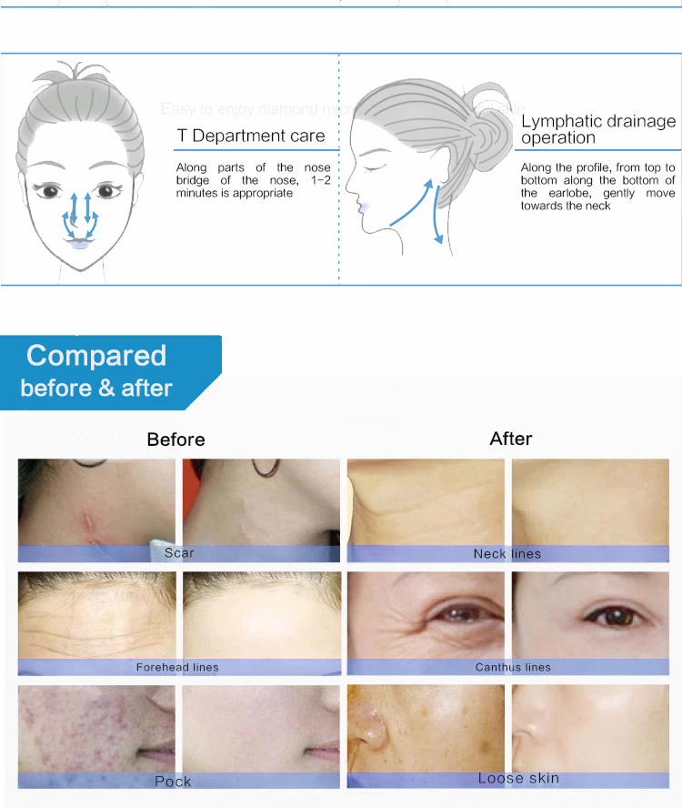 Best price vacuum terapia detox skin lightening beauty and personal care mircodermabrasion machine
