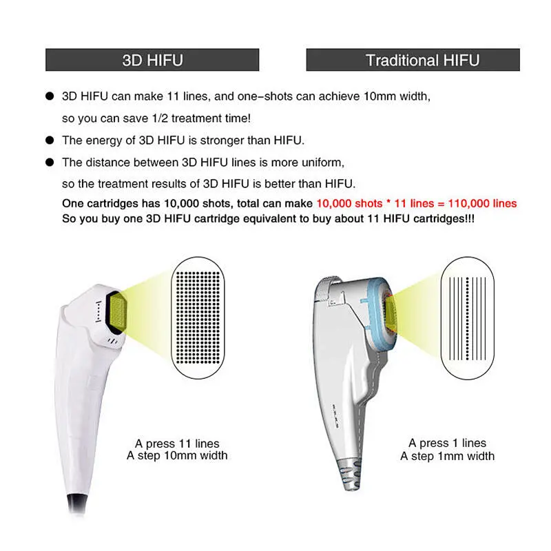 3D hifu machine