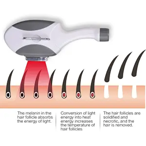 Portable hair remove machine