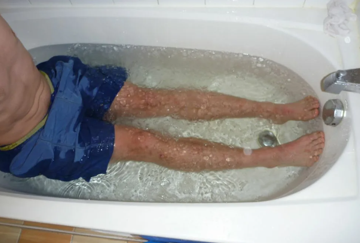 how cold does an ice bath need to be
