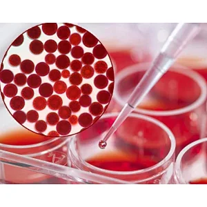 Haematococcus Pluvialis