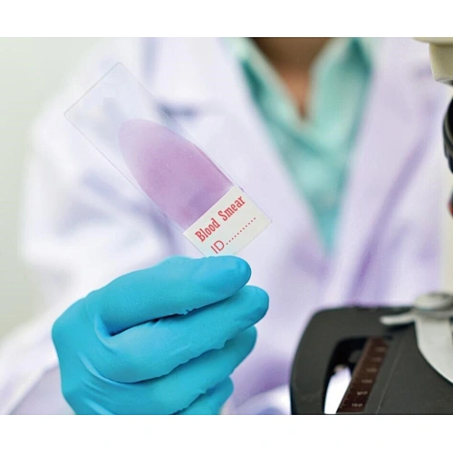 Blood Smear Microscope Slides for Performing Blood Smears