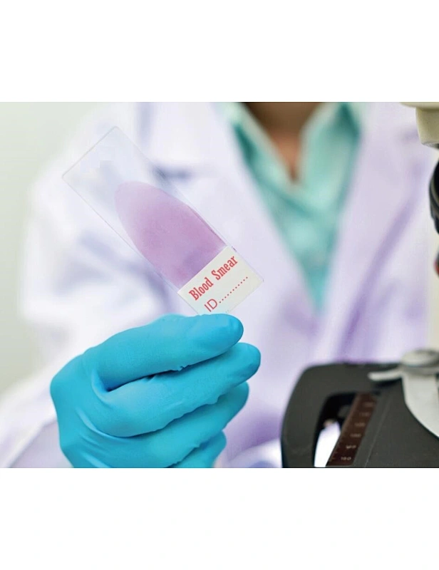 Automatic Blood Smear Microscope Slides