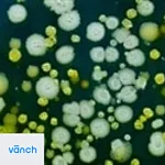 Screening patients for hidden reservoirs of bacteria could supplement infection-control efforts in hospitals