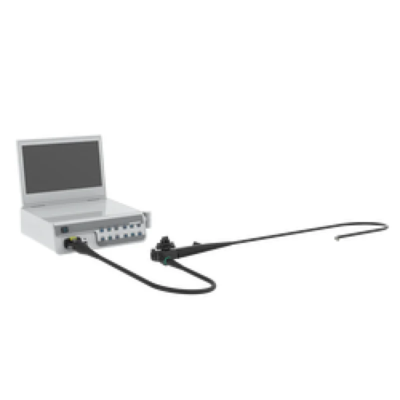 endoscopy gastroscopy