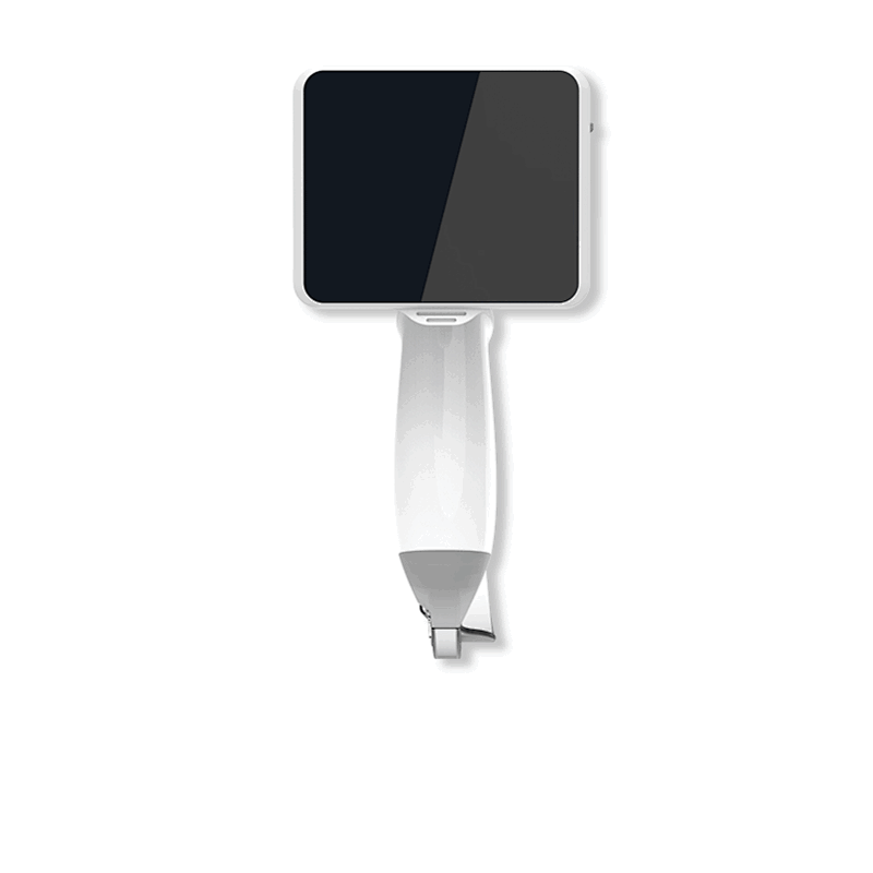 video laryngoscope