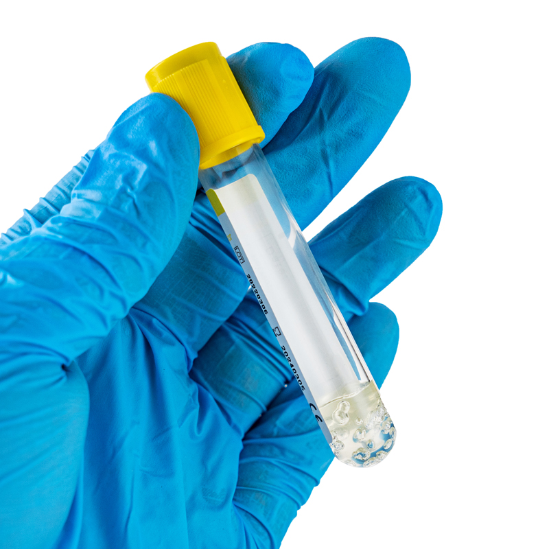 Yellow Blood Collection Tube