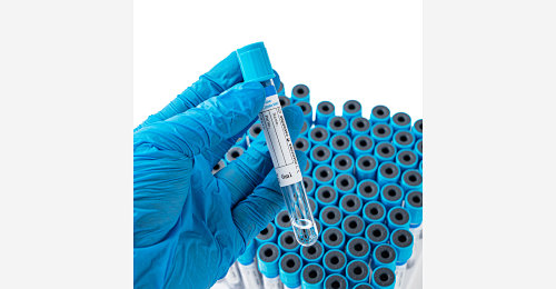 Blue Top Blood Collection Tube - Yongkang Medical