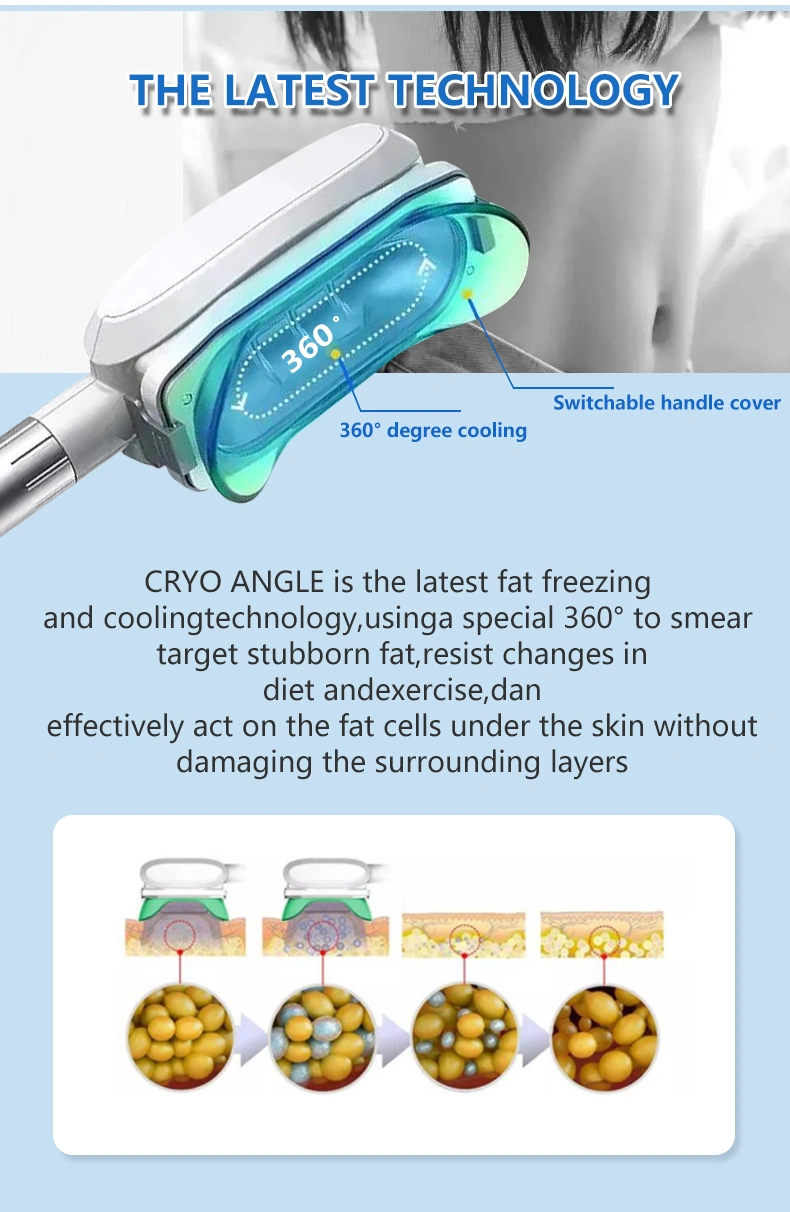 Fat freezing Muscle building