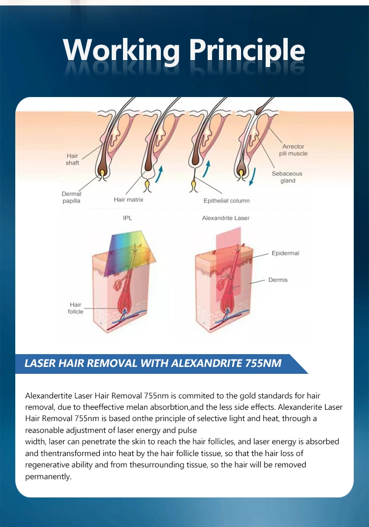 755nm laser alex hair removal