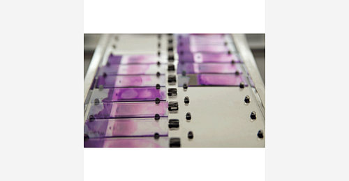 RM7310A Automatic Blood Smear Microscope Slides-Automatic Blood Smear ...