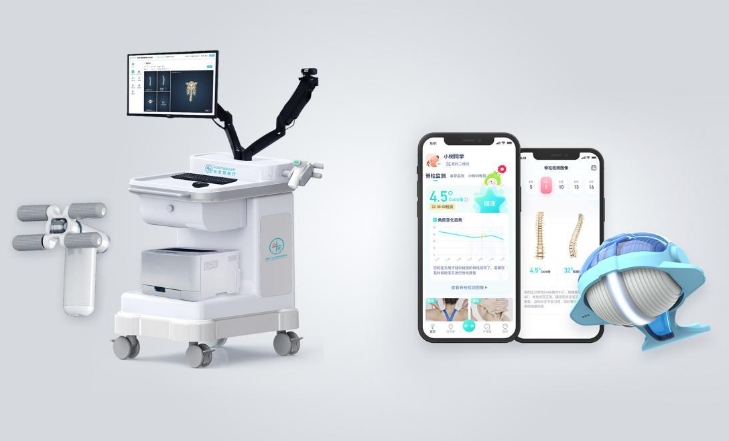 Forethought Handheld Screening for Scoliosis