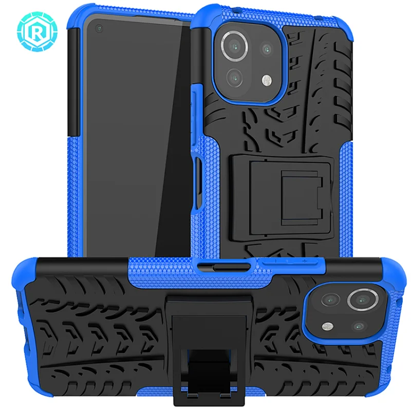 Xiaomi 11 Lite Dazzle Phone Case