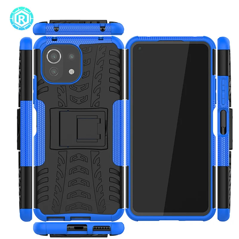 Xiaomi 11 Lite Dazzle Phone Case