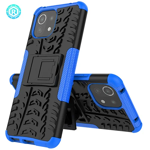 Xiaomi 11 Lite Dazzle Phone Case