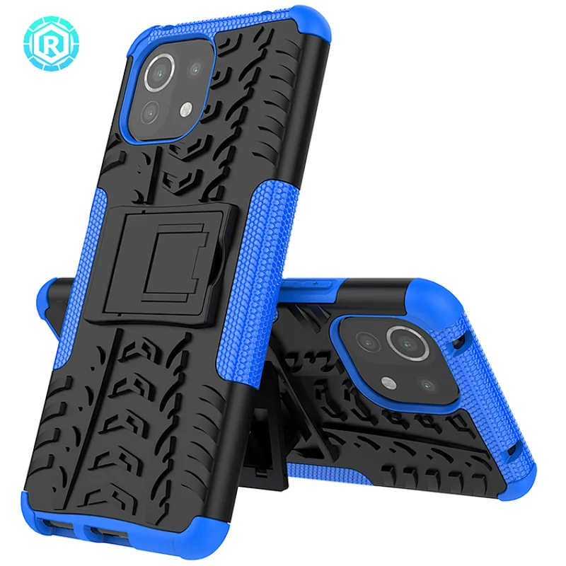 Xiaomi 11 Lite Dazzle Phone Case