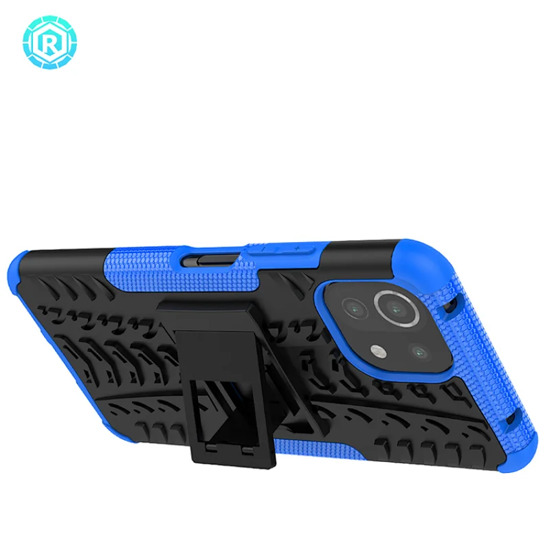 Xiaomi 11 Lite Dazzle Phone Case