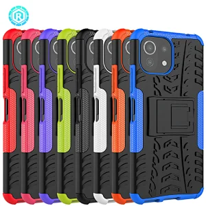 Xiaomi 11 Lite Dazzle Phone Case